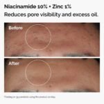 THE ORDINARY The Skin Support Set with Niacinamide + Hyaluronic Acid - Image 2