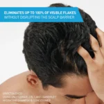 CeraVe Hydrating 2 in 1 Anti Dandruff Shampoo and Conditioner Itchy Scalp Treatment 355ml - Image 2