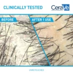 CeraVe Hydrating 2 in 1 Anti Dandruff Shampoo and Conditioner Itchy Scalp Treatment 355ml - Image 3